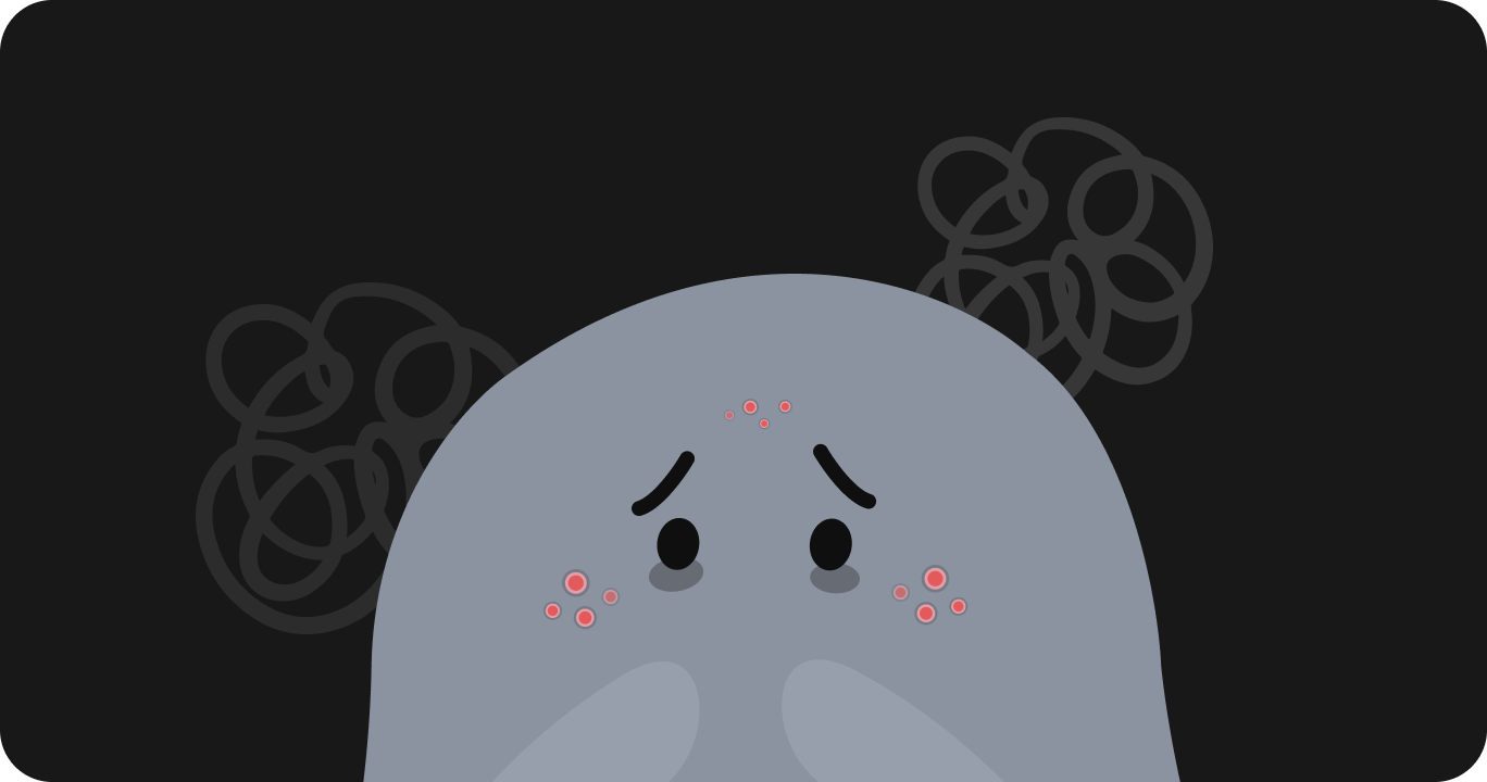 睡眠不足によってニキビが繰り返しできる状態