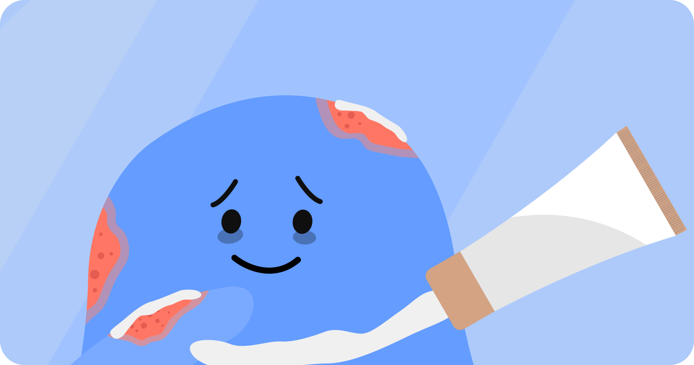 アトピー性皮膚炎の患部に治療薬を塗っている様子